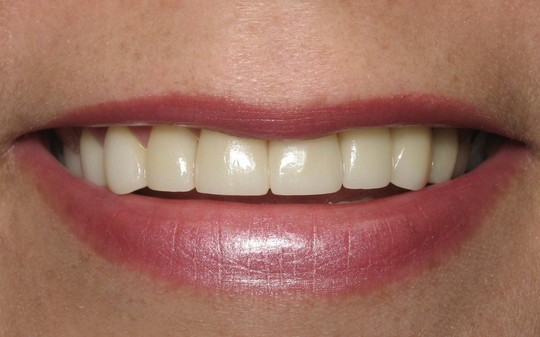 fresno dentist