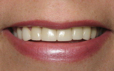 5 Tips for a Great Smile | Dr Donan, Dentist Fresno CA