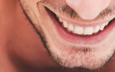 Clear Braces For Adults | Clear Braces In Fresno CA