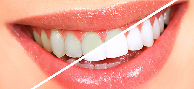 Fresno Dentist | General Dentistry | Dr. Donan DDS