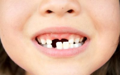 Everything About Baby Teeth | Dentist Fresno CA