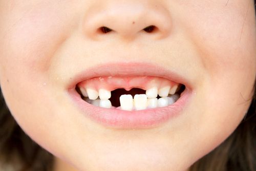 dentist fresno ca