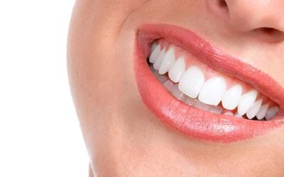 Ways To Keep Teeth As Withe As Snow