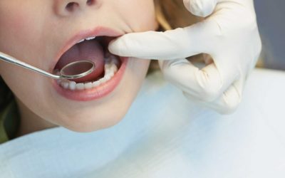 The 9 most common dental problems! | Dentist Fresno CA