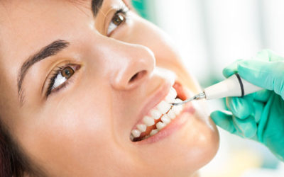 How Often Should I Go to the Dentist for a Teeth Cleaning? | Dentist in Fresno CA