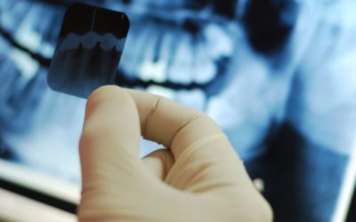 How Safe Are Dental X-Rays?