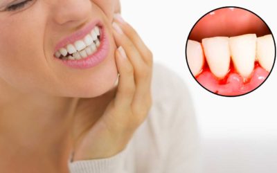 Bleading gums, what it means and what you need to do.