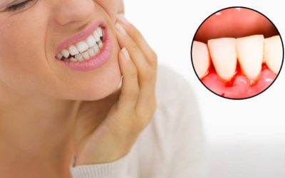 Bleading gums, what it means and what you need to do.