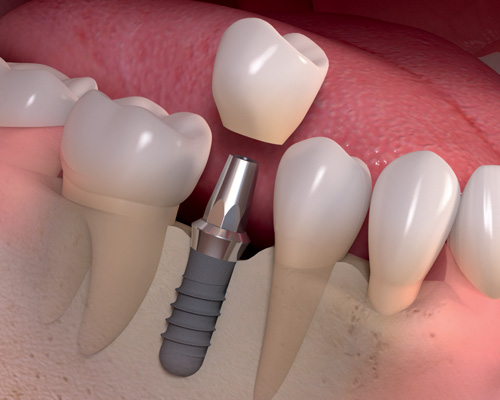 dentist fresno