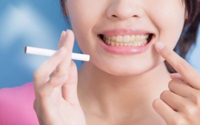 How Does Smoking Affect Your Teeth? | Fresno dentist