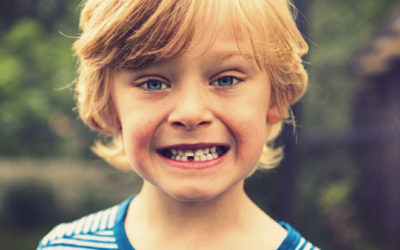 Common Questions Parents Ask About Their Child’s Teeth | Dentist Fresno CA
